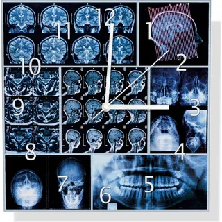 Wallario Design Wanduhr Röntgen-Bilder eines menschlichen Kopfes von allen Seiten aus Aluverbund, Größe 30 x 30 cm - Blau