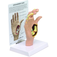 GPI Anatomicals 1930 Hand Modell Arthrose