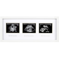Pearhead Pregnancy Trimester Sonogram Frame, Ultrasound Picture Frame, Pregnancy Milestone Keepsake Photo Frame, Sonogram Keepsake, Gender-Neutral Baby Nursery Décor, 1st 2nd and 3rd Trimester, White