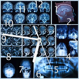 Wallario Design Wanduhr Röntgen-Bilder eines menschlichen Kopfes von allen Seiten aus Echtglas, Größe 20 x 20 cm - Blau