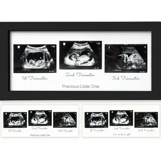 KeaBabies Trio Baby Bilderrahmen für Ultraschallbilder - Bilderrahmen Ultraschallbild Baby, Ultraschall Fotorahmen Schwangerschaft, Ultraschallbilder Rahmen, Geschenke für Werdende Mamas (Onyx Black)