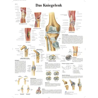 3B Scientific Lehrtafel des Kniegelenks, Anatomieposter des Knies, Lehrtafel zu Bändern, Meniskus & Pathologien für Medizin- & Anatomieunterricht