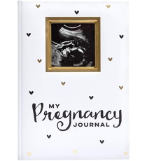 Pearhead My Pregnancy Journal, Baby Andenken, Schwangerschafts-Erinnerungsbuch, Weiß und Gold mit schwarzen Herzen