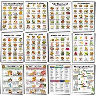 sinload 12 Stück Fettleber Lebensmittelposter Fettleber Diät Lebensmittelliste Gesundheit Ernährung Lebensmittel Leitfaden für Zimmer Küche Dekor
