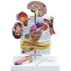 GPI Anatomicals W33386 Diabetes Modell, mini Set, 4 Stück
