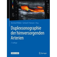 Duplexsonographie der hirnversorgenden Arterien