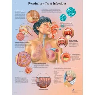 3B Scientific Atemwege Diagramm, laminated, 1