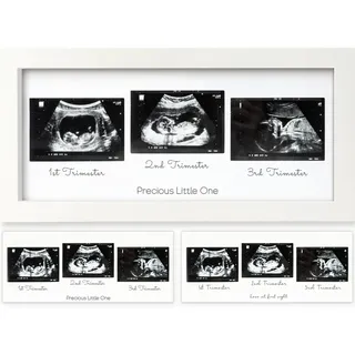 Trio Baby Bilderrahmen für Ultraschallbilder - Bilderrahmen Ultraschallbild Baby, Ultraschall Bilderrahmen Schwangerschaft, Ultraschallbilder Rahmen, Geschenke für Werdende Mamas (Alpine White)