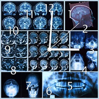 Wallario Design Wanduhr Röntgen-Bilder eines menschlichen Kopfes von allen Seiten aus Echtglas, Größe 30 x 30 cm - Blau