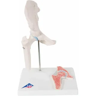 3b Scientific A84/1 Mini-Hüftgelenk mit Querschnitt, inkl. gratis Anatomie-Software „3B Smart Anatomy“