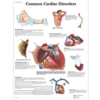 3B Scientific Lehrposter Häufige Herzerkrankungen Diagramm