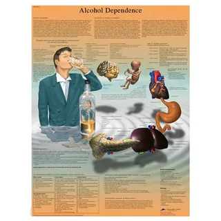 3B Scientific Alkohol Abhängigkeit Diagramm, laminated, 1