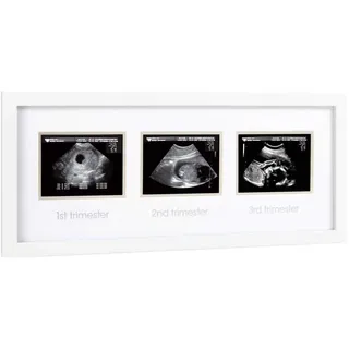 Pearhead Pregnancy Trimester Sonogram Frame, Ultrasound Picture Frame, Pregnancy Milestone Keepsake Photo Frame, Sonogram Keepsake, Gender-Neutral Baby Nursery Décor, 1st 2nd and 3rd Trimester, White