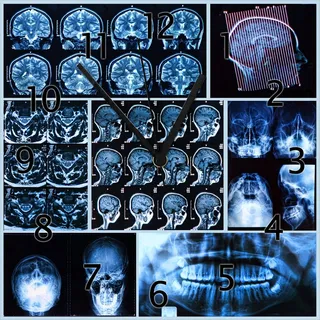 Wallario Design Wanduhr Röntgen-Bilder eines menschlichen Kopfes von allen Seiten aus Echtglas, Größe 30 x 30 cm - Blau