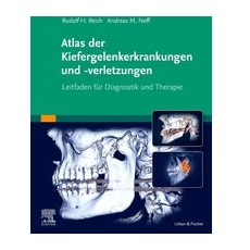 Atlas der Kiefergelenkerkrankungen und -verletzungen