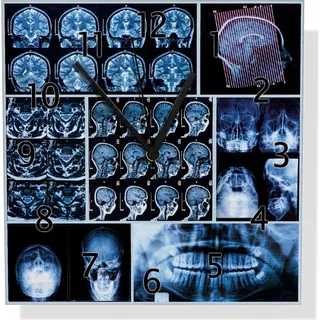 Wallario Design Wanduhr Röntgen-Bilder eines menschlichen Kopfes von allen Seiten aus Aluverbund, Größe 30 x 30 cm - Blau